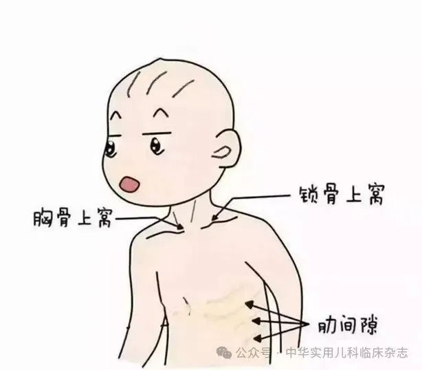 儿童急性喉炎如何预防？@家长们 这些知识很重要！ - 新华网客户端