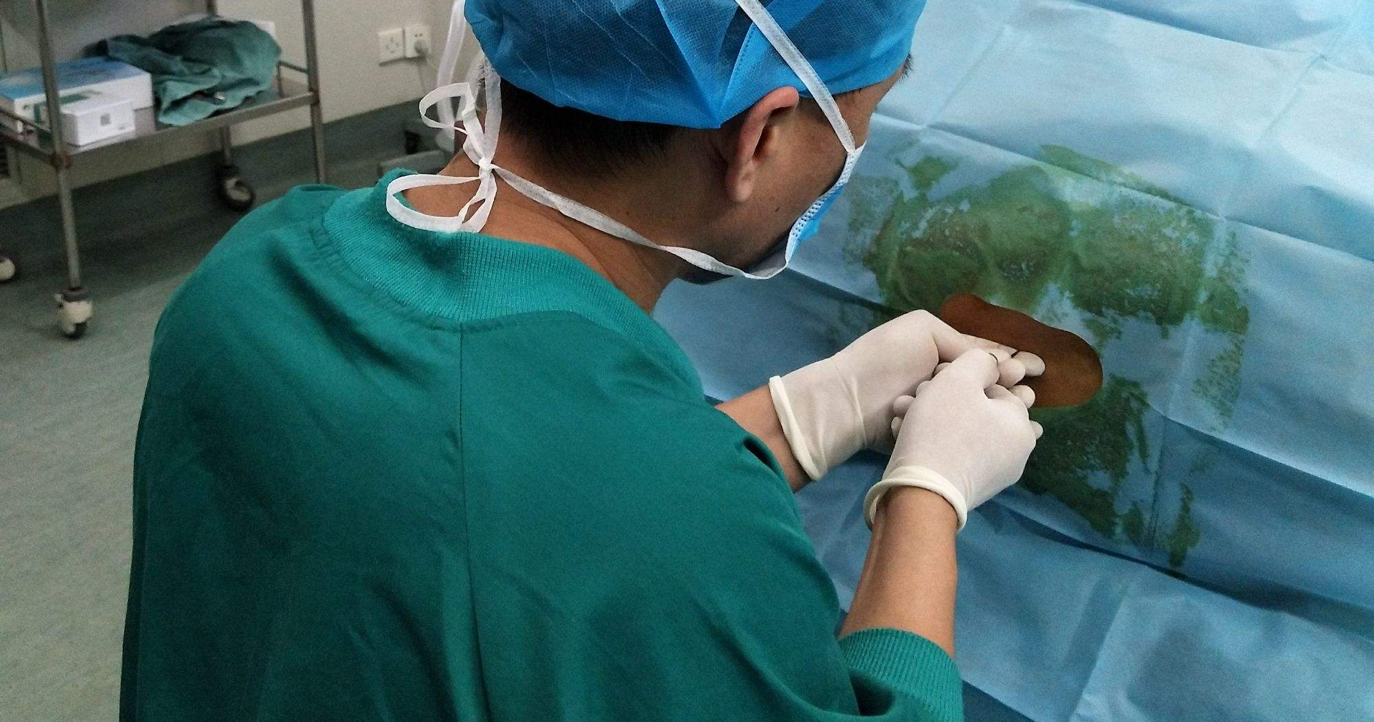 全麻腹腔镜阑尾切除术体验报告 - 知乎